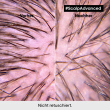 LOr&eacute;al Professionnel Serie Expert Scalp Advanced Anti-Discomfort Intense Soother Treatment 200ml Haarmaske
